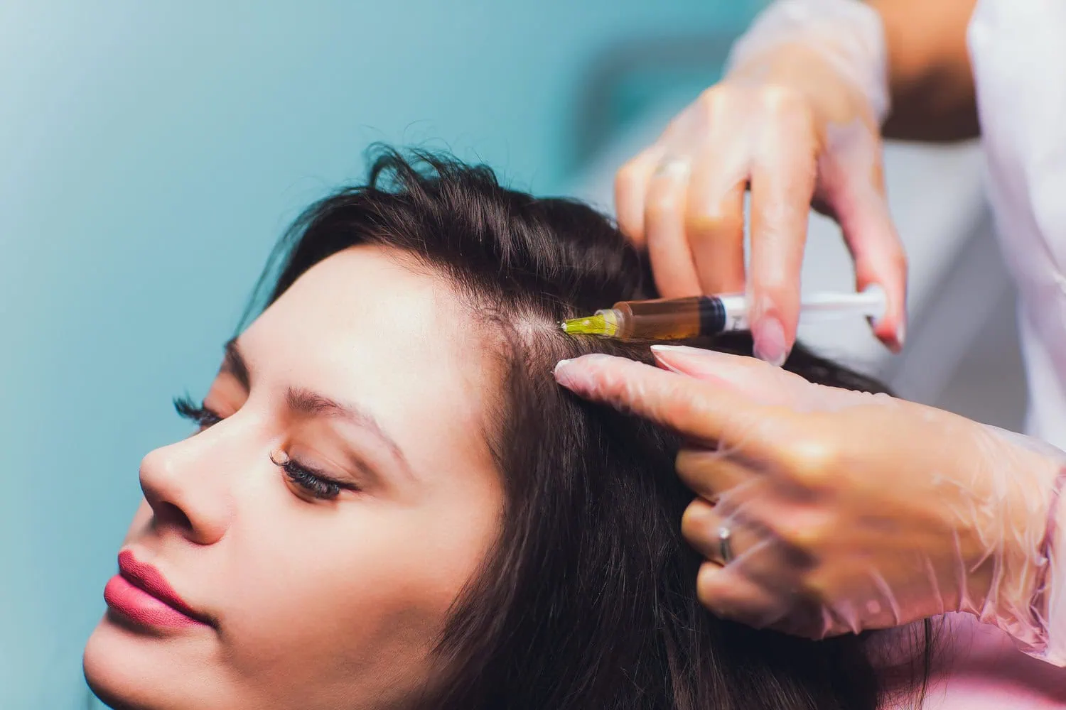 Hair Restoration Treatment by Artmedica Aesthetics