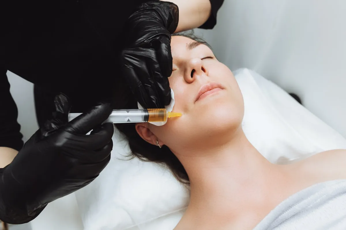 A woman receiving a PRF EZ Gel by Artmedica Aesthetics