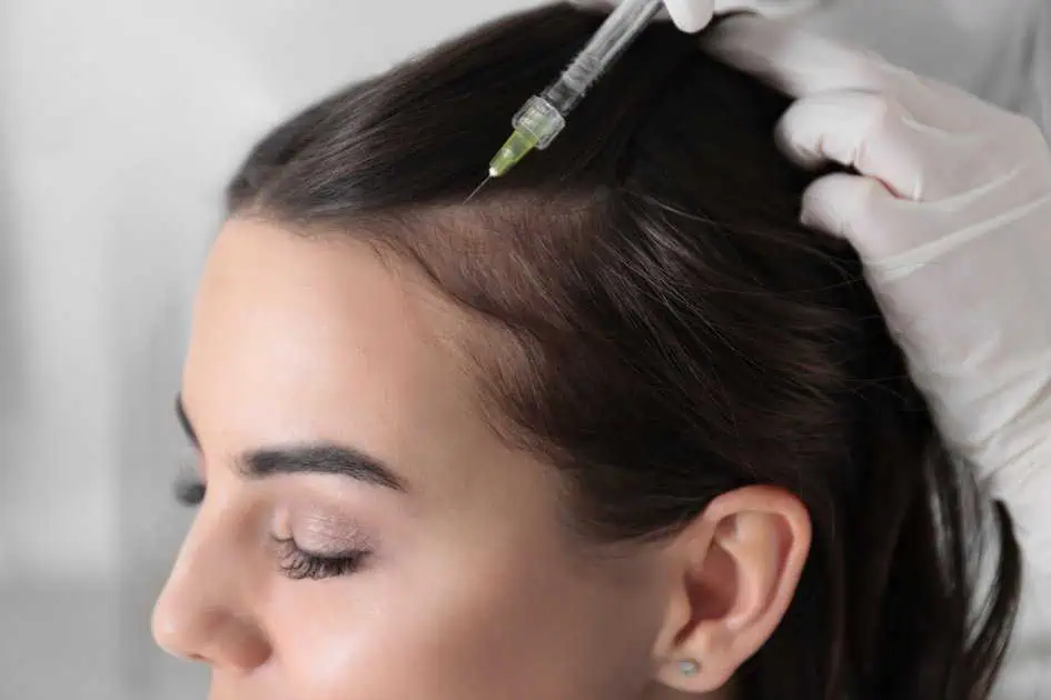 Hair Restoration at Artmedica Aesthetics in Vienna, VA